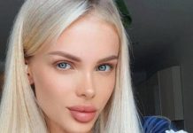 Богатый ухажер зверски избил 33-летнюю модель: ей провели трепанацию черепа