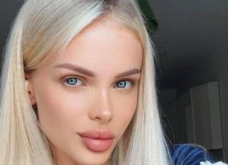 Богатый ухажер зверски избил 33-летнюю модель: ей провели трепанацию черепа