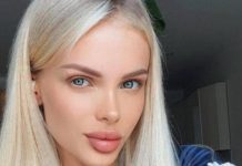 Лишившаяся части головы модель Анжелика Тартанова помирилась с бывшим-истязателем